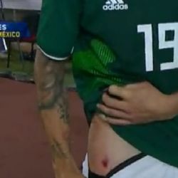 Vídeo | Miguel Layún muestra su herida del partido ante Argentina