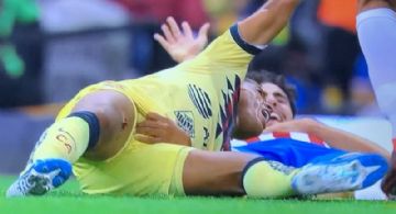 Impresionante | Terrible Lesión de Giovani dos Santos en el Clásico Nacional