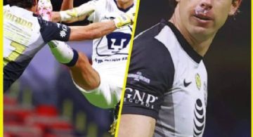 Así quedó el rostro de Oscar Jiménez tras golpazo con Dinneno