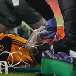 La cicatriz que le quedó a Raúl Jiménez tras su fractura de cráneo