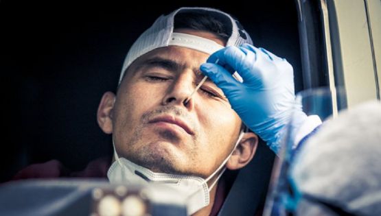 América adelanta las pruebas de covid-19 por jugadores con síntomas en el equipo