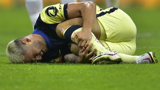 El futbolista colombiano Nicolás Benedetti reaparece con América tras una larga ausencia por lesión