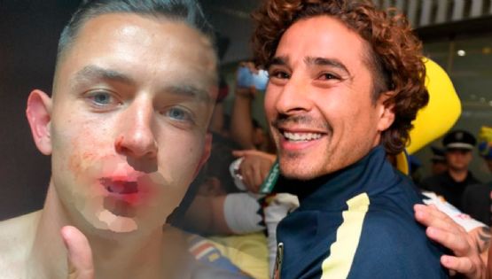 Memo Ochoa bromea con Álvaro Fidalgo por el codazo que recibió que le dejó una gran herida en la boca