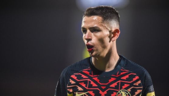 Álvaro Fidalgo habla sobre las puntadas que recibió por el codazo en el partido de América contra Santos Laguna