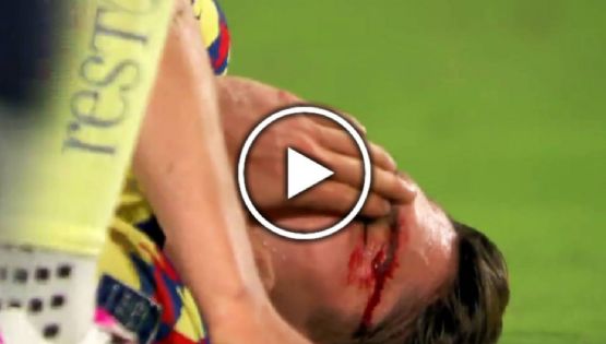 Israel Reyes termina ENSANGRENTADO tras terrible CODAZO de futbolista de Chivas