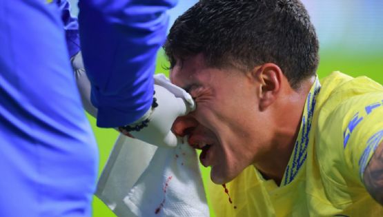 Alejandro Zendejas ARRIESGA SU FÍSICO para jugar contra la Selección Mexicana