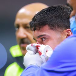 Así luce la NUEVA MÁSCARA de protección de Alejandro Zendejas que utilizará con el Club América
