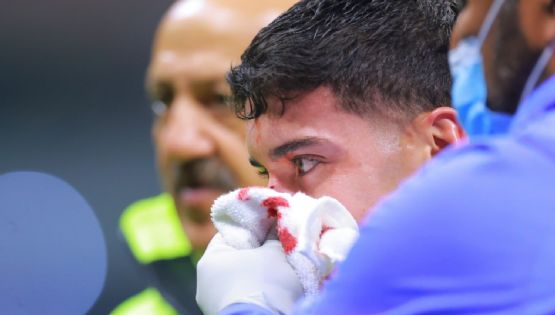 Así luce la NUEVA MÁSCARA de protección de Alejandro Zendejas que utilizará con el Club América