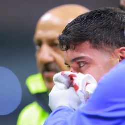Primer reporte sobre la FUERTE HERIDA de Alejandro Zendejas tras el partido ante Rayados