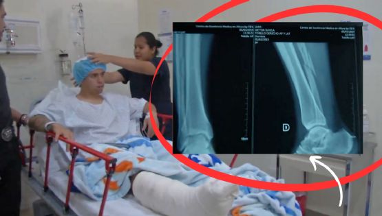 Doctor de los Tuzos del Pachuca recuerda cómo fue atender una de las lesiones más graves que sufrió Víctor Dávila cuando estuvo en la Bella Airosa