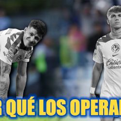 ¿Por qué el Club América decidió OPERAR a dos de sus jugadores EL DÍA DE LA FINAL vs Cruz Azul?