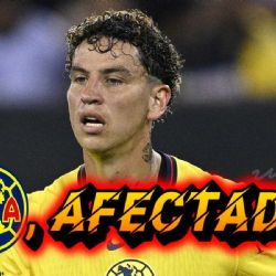 ¿Realmente PIERDE el Club América con la lesión de Igor Lichnovsky en el Apertura 2024?