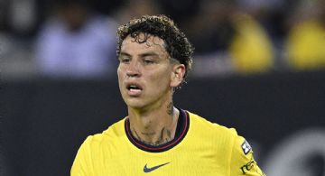 Revelan el SACRIFICIO que hizo Igor para JUGAR el Club América vs Colorado Rapids