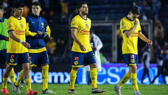 BAJA SENSIBLE de Última Hora en el Club América para enfrentar a Santos Laguna