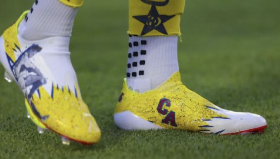 Sufrió una grave LESIÓN y será baja 10 MESES con el Club América