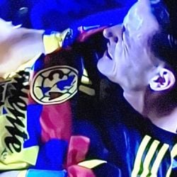 América vs Chivas: Álvaro Fidalgo enciende las ALARMAS tras salir del Clásico Nacional
