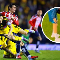 El primer reporte sobre la LESIÓN de Álvaro Fidalgo en el Clásico Nacional contra Chivas