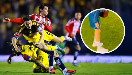 El primer reporte sobre la LESIÓN de Álvaro Fidalgo en el Clásico Nacional contra Chivas