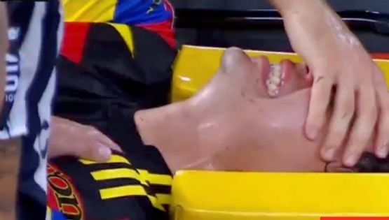 No se vio en televisión, pero fue la imagen más ENTERNECEDORA tras la lesión de Dagoberto Espinoza