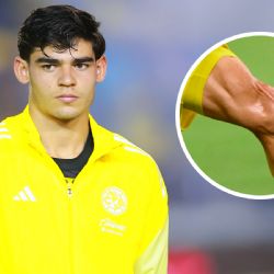El primer LAMENTABLE reporte sobre la lesión de Dagoberto Espinoza con el Club América