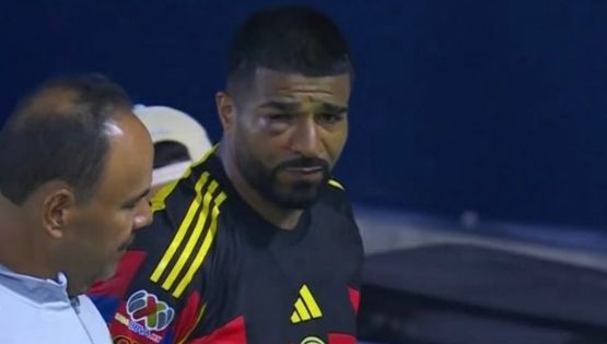 Club América pierde a Rodrigo Aguirre tras tremendo golpe que lo dejó IRRECONOCIBLE