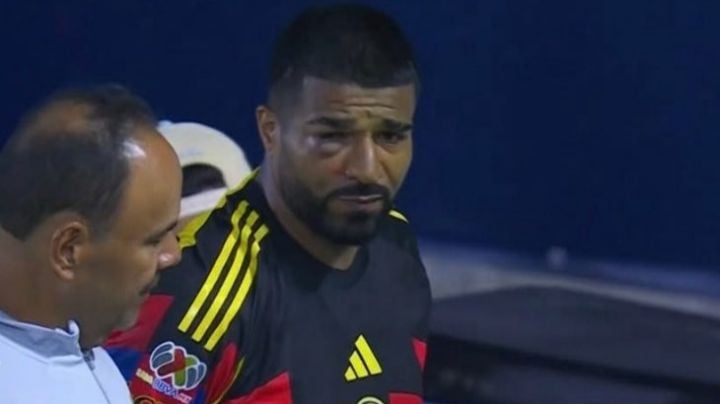 Club América pierde a Rodrigo Aguirre tras tremendo golpe que lo dejó IRRECONOCIBLE
